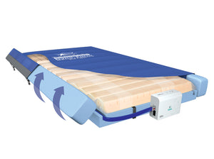 Removable sides on the Direct Healthcare Group Dyna-Form Mercury Advance Bari WA Active Hybrid Bariatric Mattress Replacement System for Pressure Ulcer Prevention