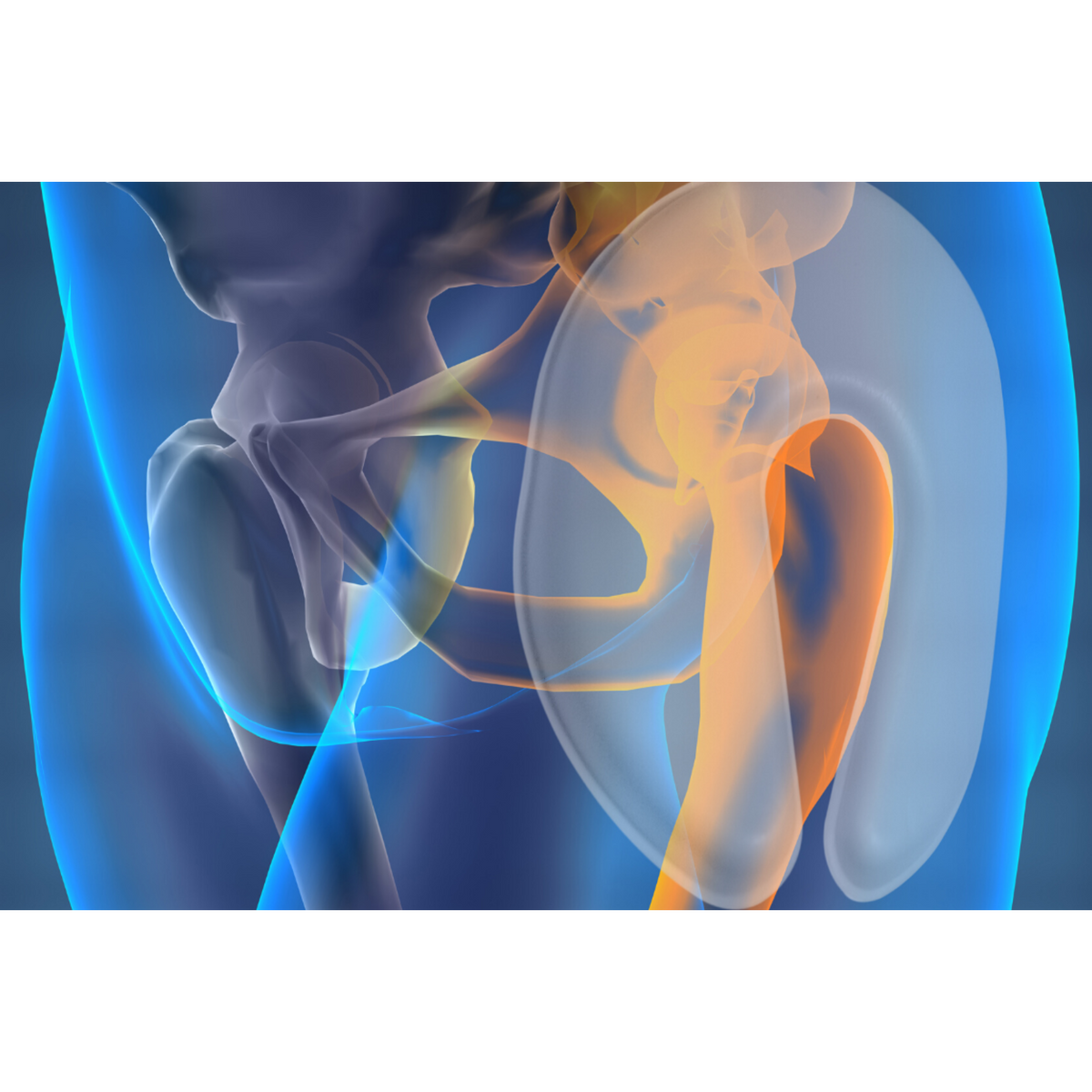 Alerta Safehip Air-X Hip Protector Protection Pants Injury Prevention Hip Support for Elderly Seniors Optimal Comfort and Protection xray